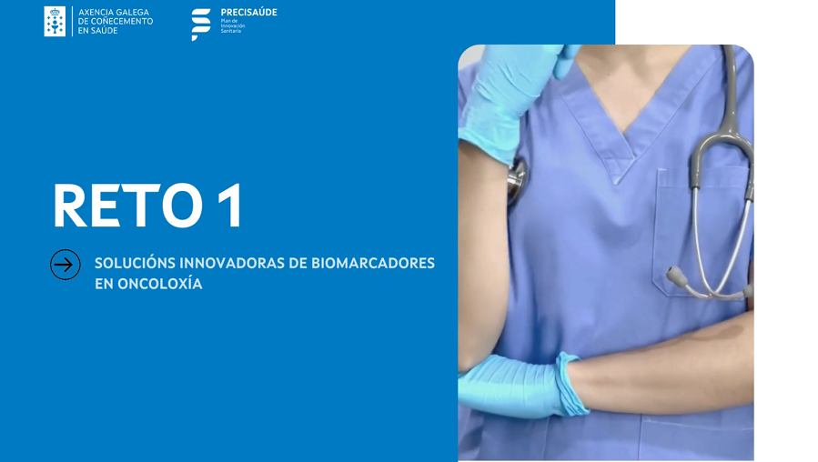 RETO 1